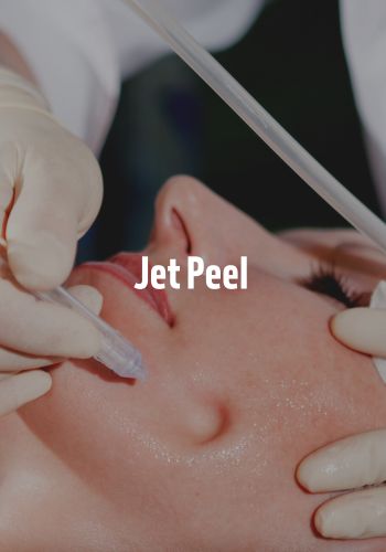 JetPeel