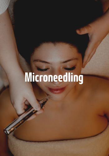 Microneedling